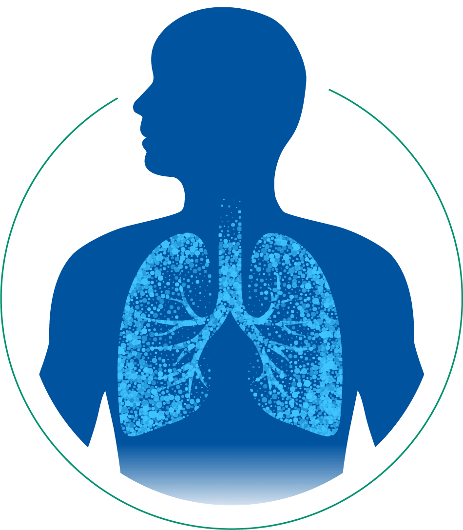 Lung Graphic